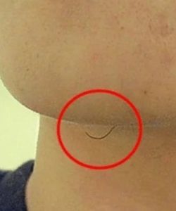 Αν είστε γυναίκα με τρίχες στο σαγόνι να τι σημαίνει για εσάς