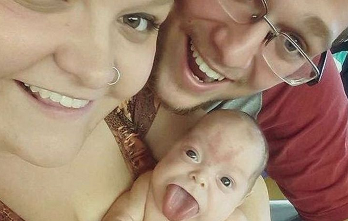 «Μωρό που γεννήθηκε με γλώσσα ενήλικα μπορεί επιτέλους να χαμογελάσει μετά από μια επέμβαση που του άλλαξε τη ζωή.»