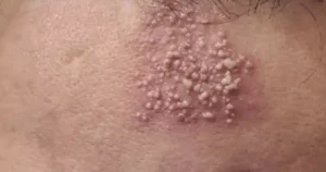 Προσοχη – Αυτές είναι οι συνέπειες του να κοιμάσαι με