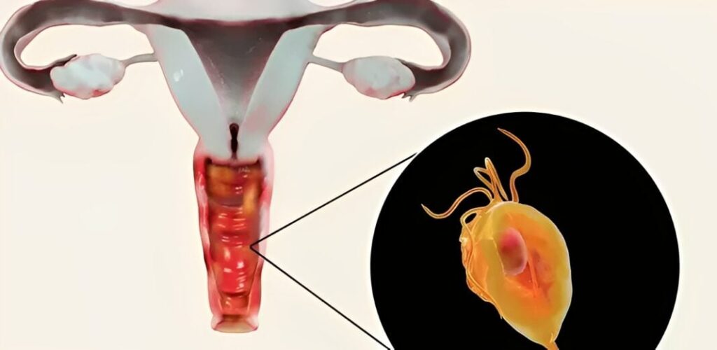 Αυτός είναι ο λόγος που τα απόκρυφα μέρη μυρίζουν σαν ψόφιο ψάρι