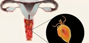 Αυτός είναι ο λόγος που τα απόκρυφα μέρη μυρίζουν σαν ψόφιο ψάρι