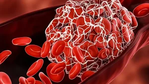 8 θρεπτικά συστατικά που χρειάζεστε για να διαλύσετε τους θρόμβους αίματος τώρα