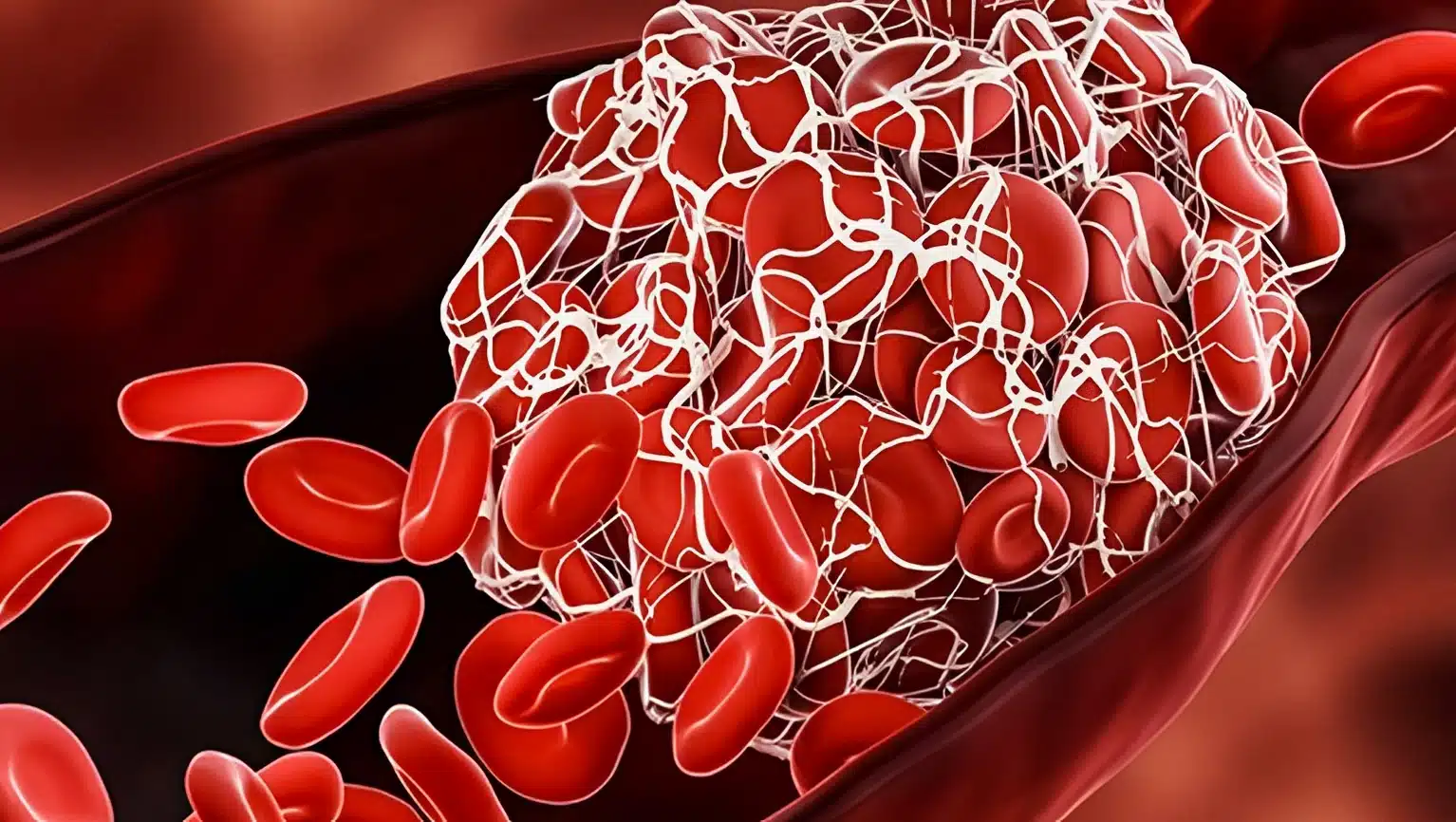 8 θρεπτικά συστατικά που χρειάζεστε για να διαλύσετε τους θρόμβους αίματος τώρα