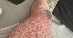 Αυτές είναι οι συνέπειες του να κοιμάσαι με…