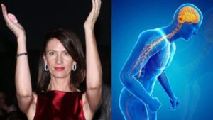 Κίλι Σφακιανάκη: Τι είναι η Νόσος Πάρκινσον από την οποία πέθανε και ποια τα συμπτώματα