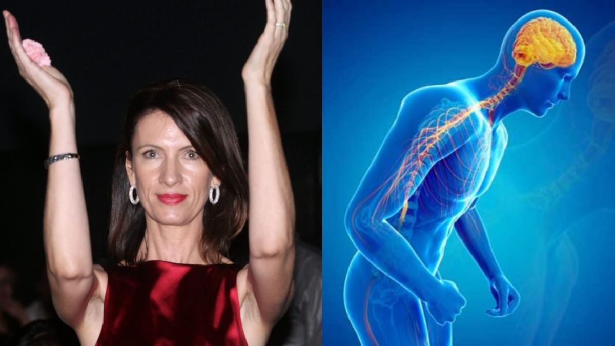 Κίλι Σφακιανάκη: Τι είναι η Νόσος Πάρκινσον από την οποία πέθανε και ποια τα συμπτώματα