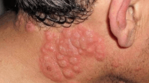 Γιατί πολλοί ειδικοί συμβουλεύουν να μην κοιμόμαστε με ανοιχτό παράθυρο