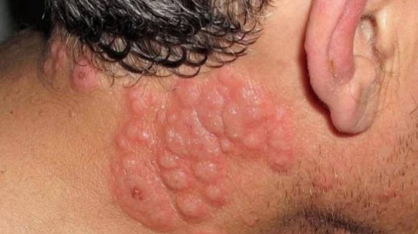 Γιατί πολλοί ειδικοί συμβουλεύουν να μην κοιμόμαστε με ανοιχτό παράθυρο