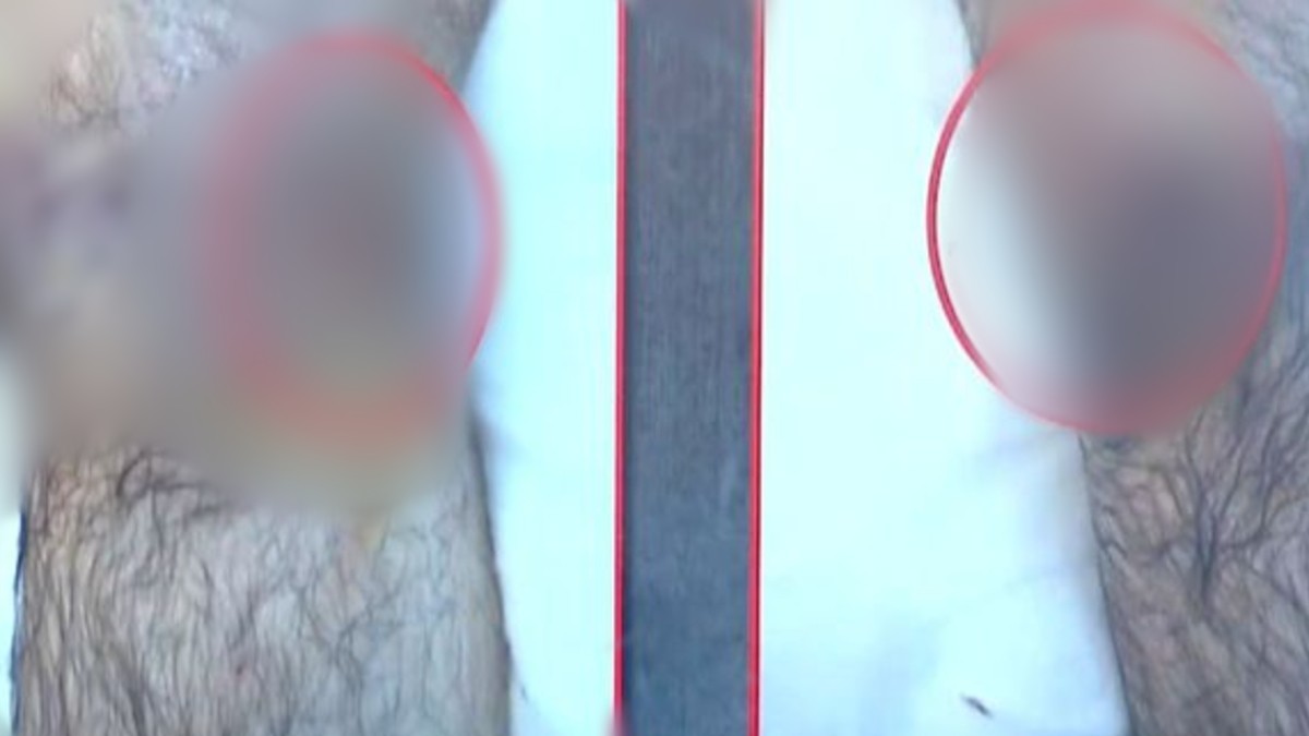 Νέες φωτογραφίες από το μακελειό στα Βορίζια: Σοκάρουν τα σημάδια από τις σφαίρες στα σώματά τους