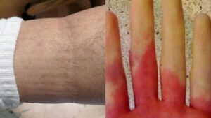 Ανακοπή καρδιάς: 6 προειδοποιητικά σημάδια που θα νιώσετε λίγες μέρες πριν