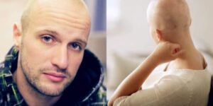 «Χημειοθεραπεία, ακτινοβολίες, πόνοι, εμετός»: Tσακίζει κόκκαλα ο Νίκος, μόλις έκλεισε τα 30 και έχει καρκίνο