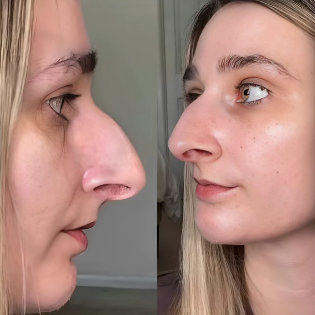 “Θα μπορούσε να τον παντρευτεί μόνο υπό έναν όρο: Πώς μια γυναίκα μεταμόρφωσε τη ζωή της και βρήκε την αληθινή αγάπη