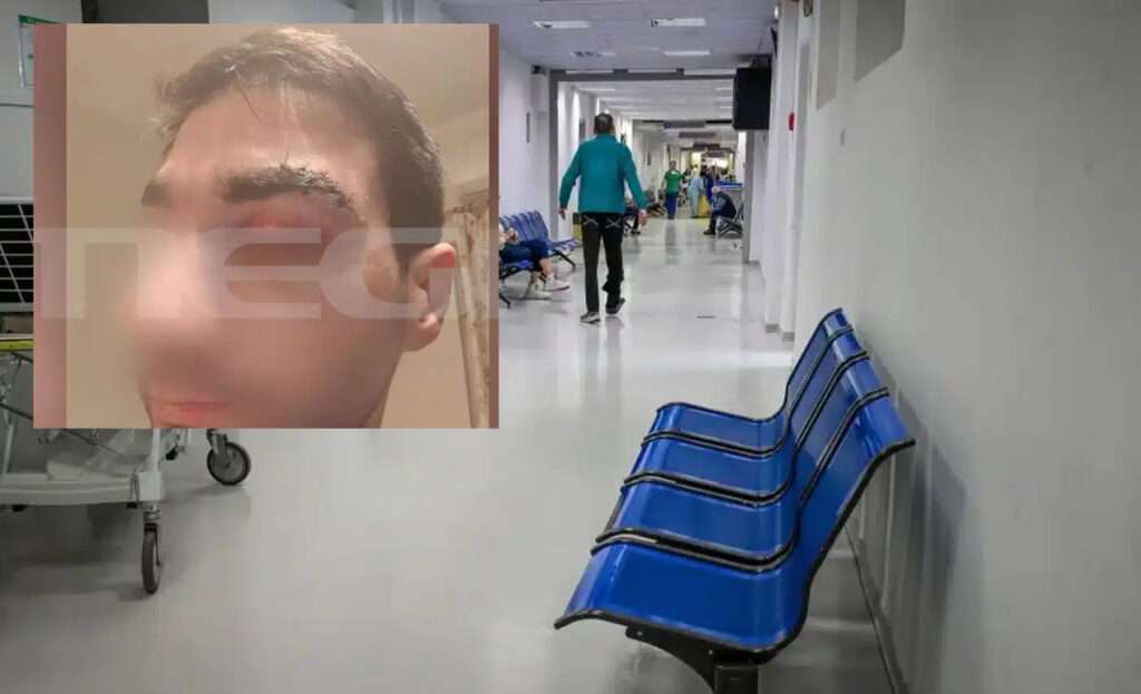 Αίγιο: Πέθανε ο 43χρονος ασθενής μποξέρ που γρονθοκόπησε γιατρό – Τι λέει ο ορθοπεδικός για την επίθεση