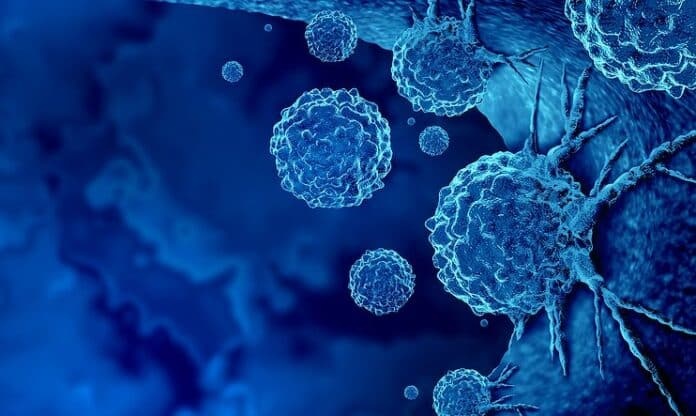 Φαίνονται «αθώα», αλλά προειδοποιοúν για καρκiνο: 6 úπουλα σημάδια που εμφανίζουν σχεδόν όλοι οι καρκινοπαθεiς