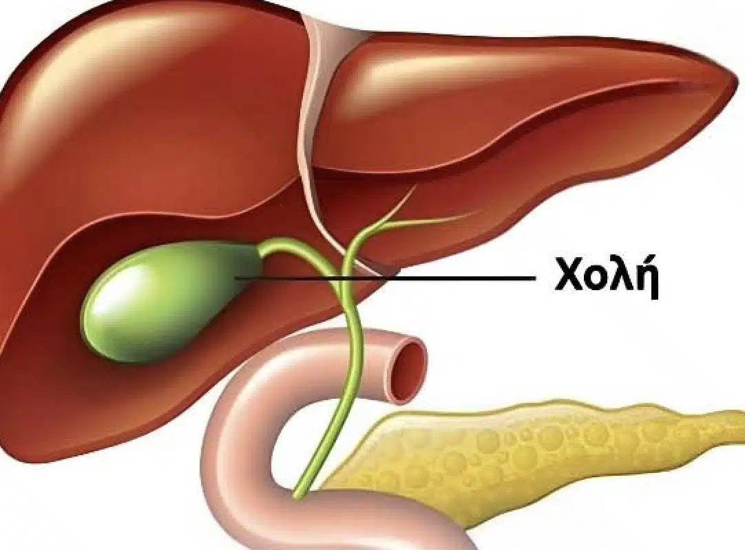 Τι συμβαίνει στο σώμα μετά την αφαίρεση της χοληδόχου κύστης; 3 ασθένειες που μπορεί να ακολουθήσουν – Αποφύγετε τη χειρουργική επέμβαση εάν είναι δυνατόν