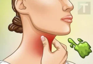 Οι πραγματικές αιτίες του συνεχούς φλέγματος στο λαιμό και πώς να απαλλαγείτε από αυτό