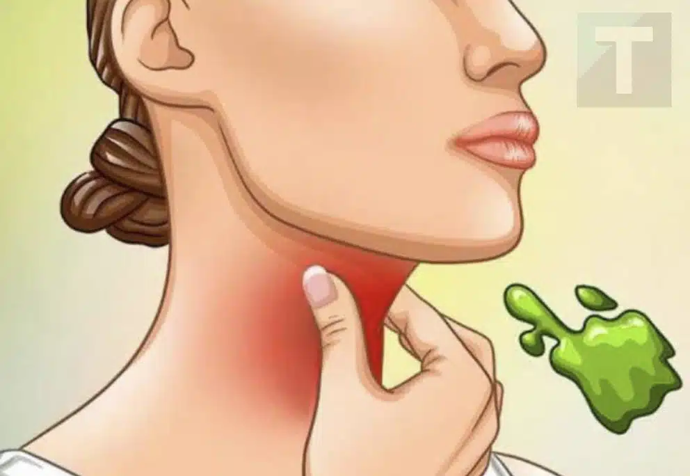 Οι πραγματικές αιτίες του συνεχούς φλέγματος στο λαιμό και πώς να απαλλαγείτε από αυτό
