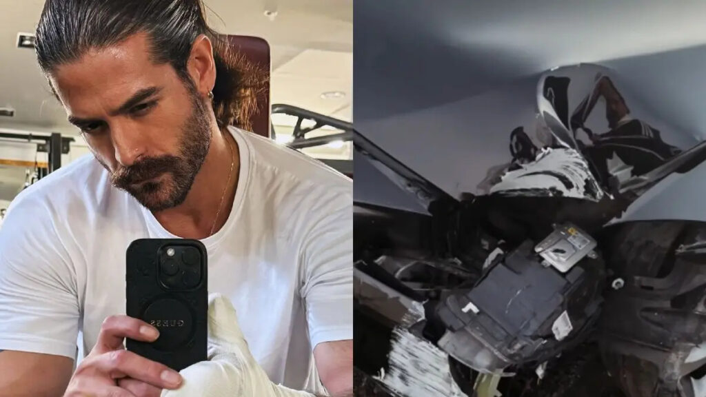 Σοβαρό τροχαίο για τον Άρη Μουγκοπέτρο – Στο νοσοκομείο ο μουσικός