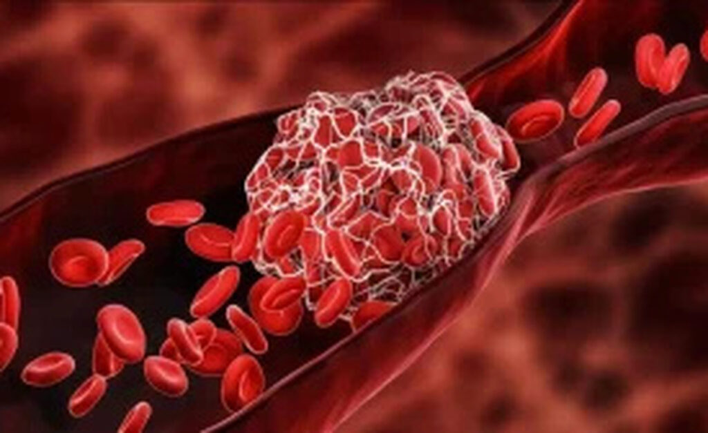 7 ισχυρές τροφές που αραιώνουν το αίμα και πρέπει να γνωρίζετε