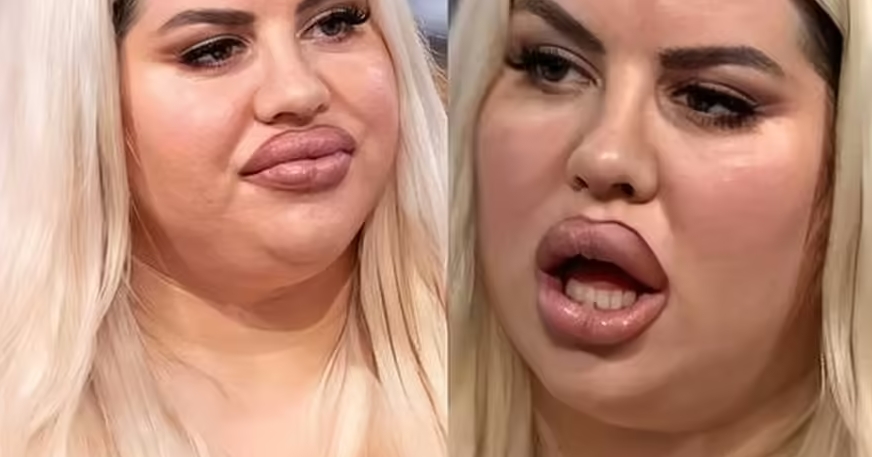 «Ξόδεψα 150.000 σε πλαστικές επεμβάσεις, αλλά δεν βρίσκω σύντροφο γιατί τρομάζω τους άντρες»