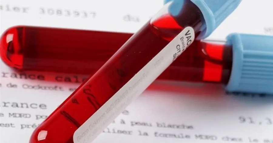 Πότε η γενική αίματoς δείχνει καρκίvο