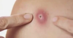 Προσοχή!! Αυτά είναι ξεκάθαρα σημάδια ότι αυτό είναι…