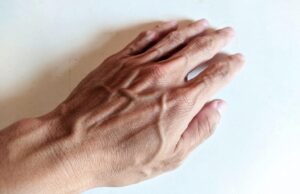 Ο χάρτης της ανθρώπινης κυκλοφορίας και οι βιολογικοί παράγοντες που διαμορφώνουν την ορατότητα του αγγειακού δικτύου