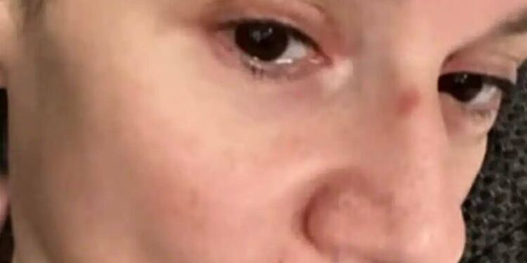 ΕΚΤΑΚΤΟ - Δύσκολες ώρες για την Ελληνίδα ηθοποιό