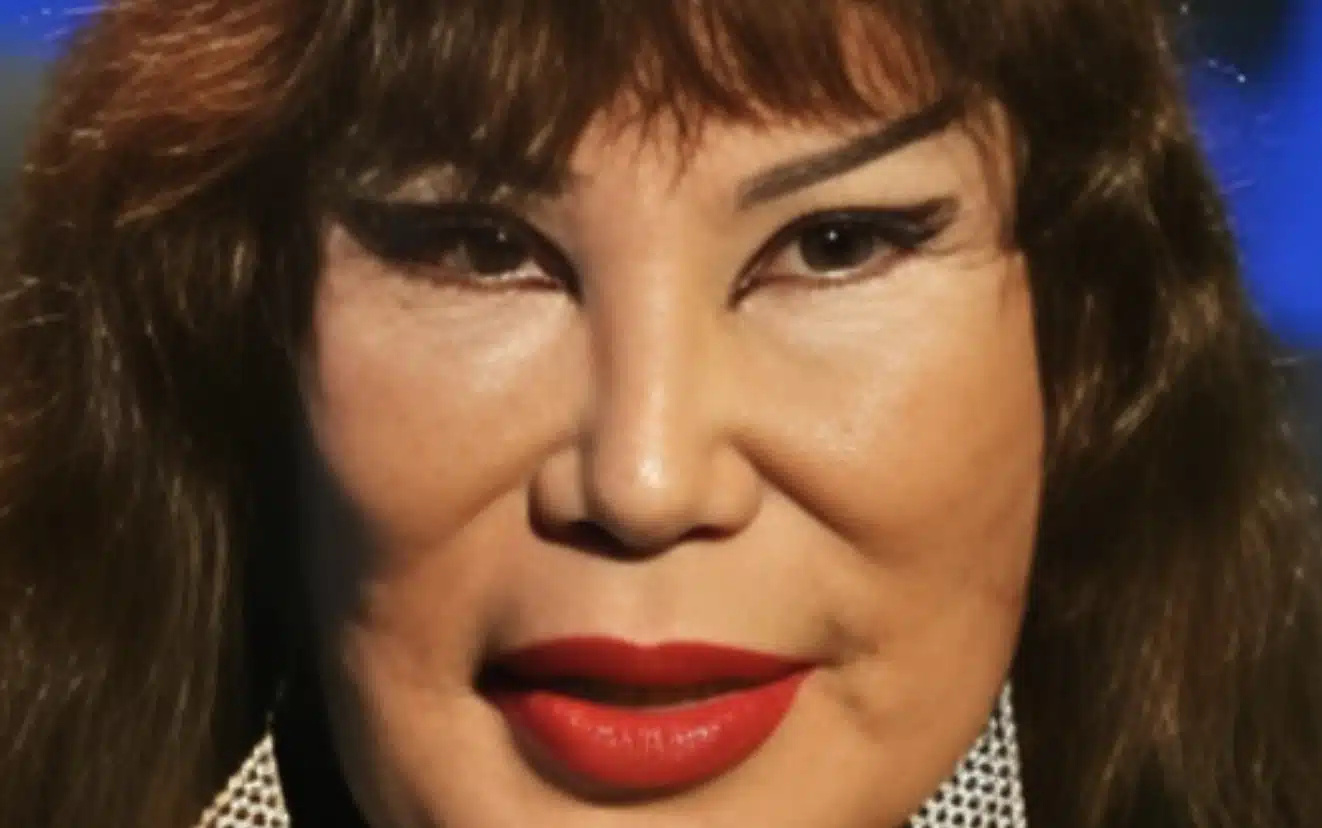 Ήταν μια διάσημη ηθοποιός που εμφανίστηκε σε περίπου 100 ταινίες, αλλά ένα τραγικό λάθος άλλαξε άρδην την εμφάνισή της