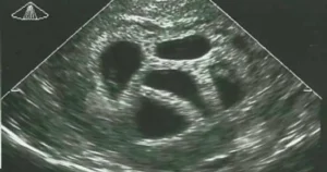 Μια έγκυος γυναίκα αγνόησε τις συμβουλές του γιατρού να κάνει έκτρωση… 20 χρόνια αργότερα δημοσιεύει αυτό!