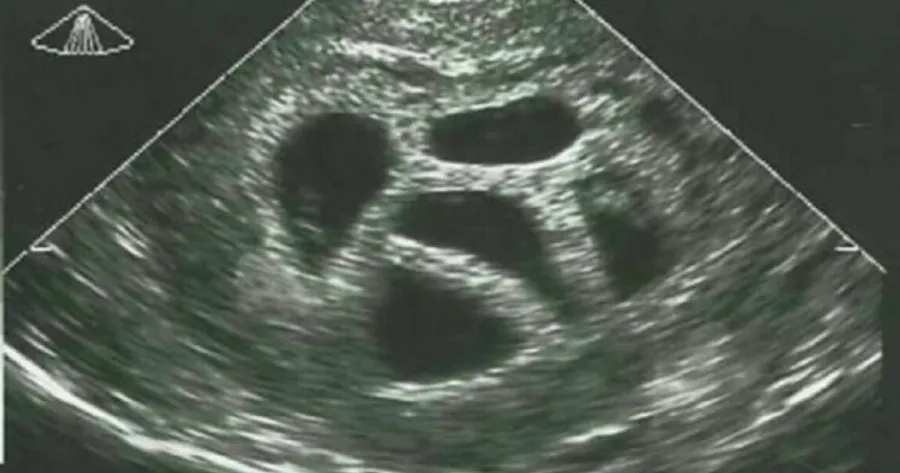 Μια έγκυος γυναίκα αγνόησε τις συμβουλές του γιατρού να κάνει έκτρωση… 20 χρόνια αργότερα δημοσιεύει αυτό!