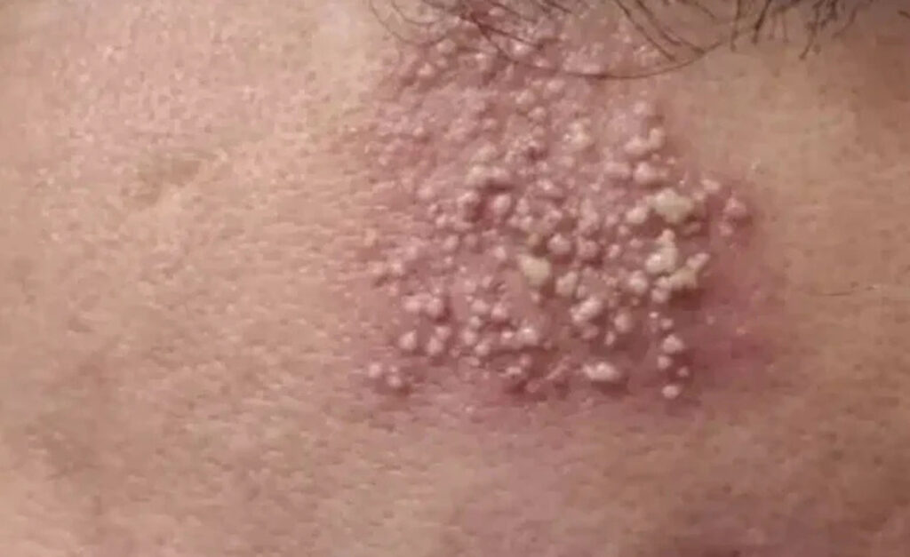 Προσοχη – Αυτές είναι οι συνέπειες του να κοιμάσαι με