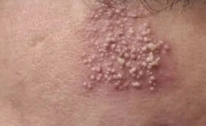 Προσοχη – Αυτές είναι οι συνέπειες του να κοιμάσαι με