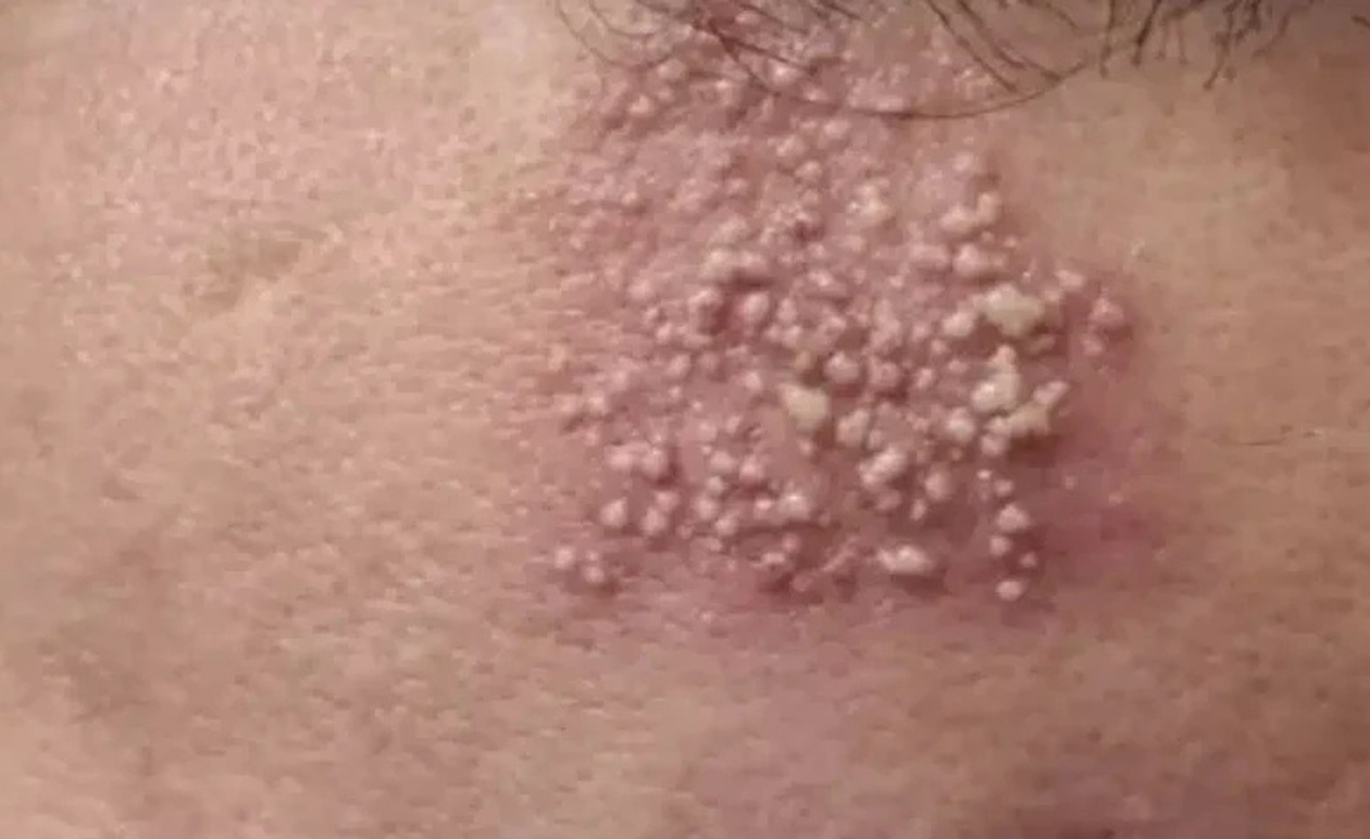 Προσοχη – Αυτές είναι οι συνέπειες του να κοιμάσαι με