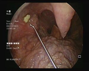 Να τι πρέπει να γνωρίζετε για αυτές τις πέτρες – Που εμφανίζονται