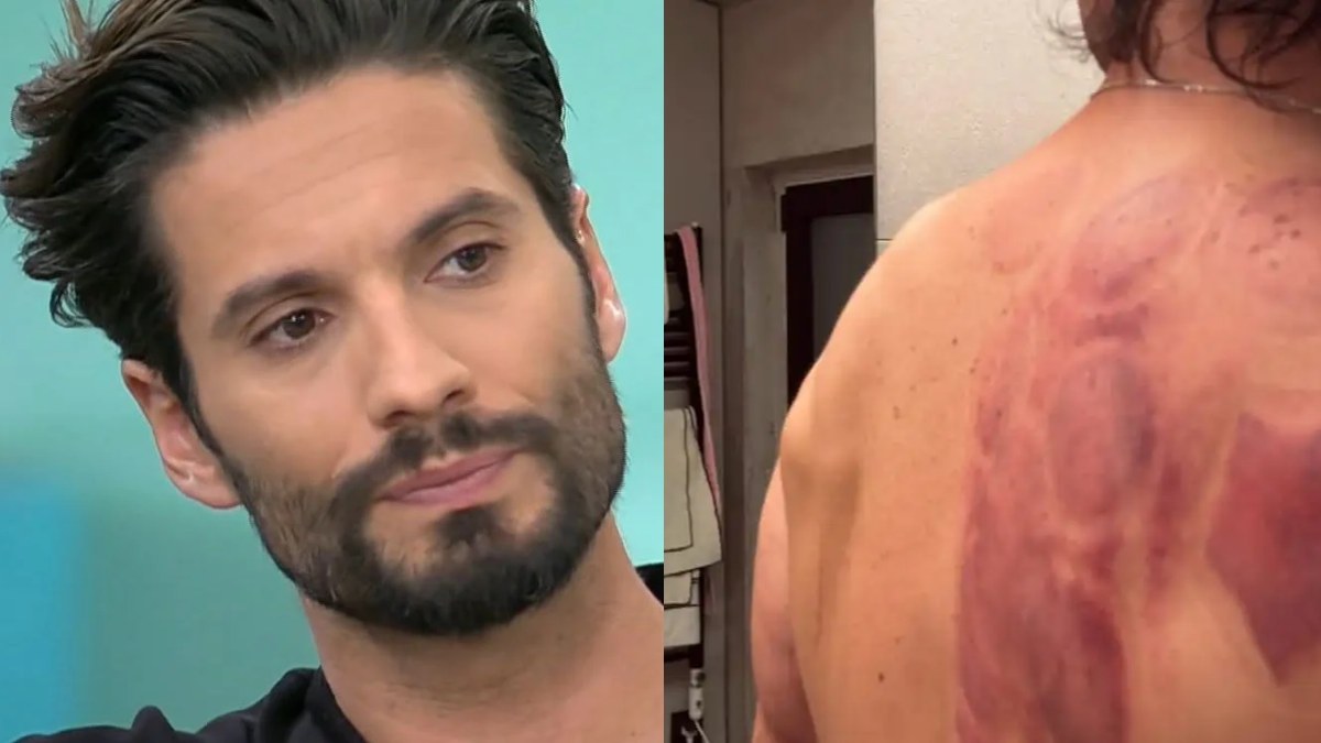 ΕΚΤΑΚΤΟ - Δύσκολες στιγμές για τον Γιώργο Καράβα: Αποκάλυψε το πρόβλημα που έχει στην ωμοπλάτη