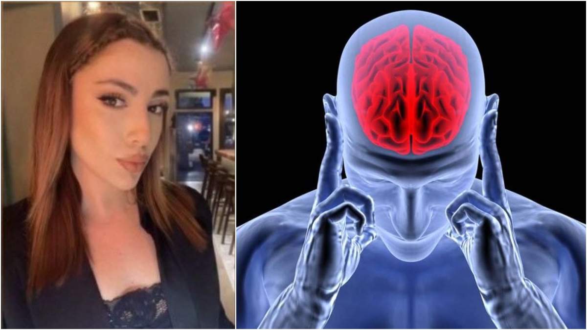 Νεκρή από εγκεφαλική αιμορραγία η 24χρονη στη Ρόδο! Τι πρέπει να κάνετε για να προλάβετε το κακό; Τα ύπουλα συμπτώματα