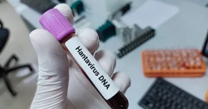 ΕΚΤΑΚΤΟ ΤΩΡΑ ΓΙΑ ΤΟΝ ΧΑΝΤΑΪΟ: Διαφορετικά τα συμπτώματα στην Ελλάδα